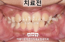 수술전