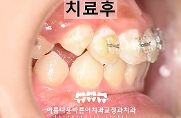 수술후