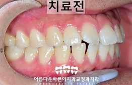 수술전