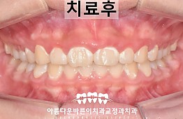 수술후