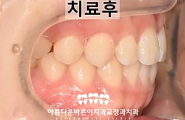 수술후