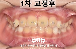 수술후