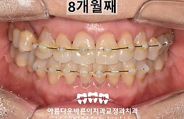 수술후