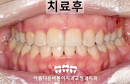 수술후