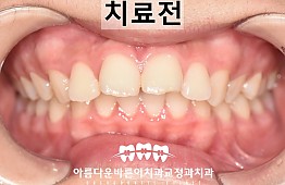 수술전