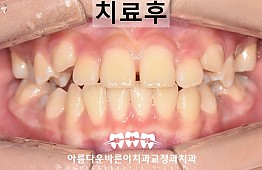 수술후