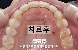 수술후