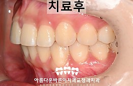 수술후