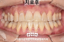 수술후