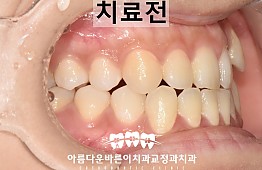 수술전