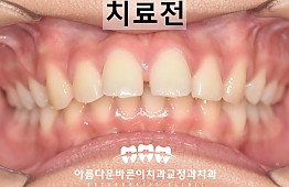 수술전