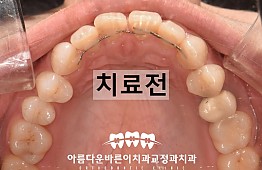 수술전