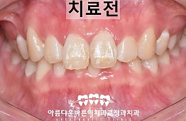 수술전